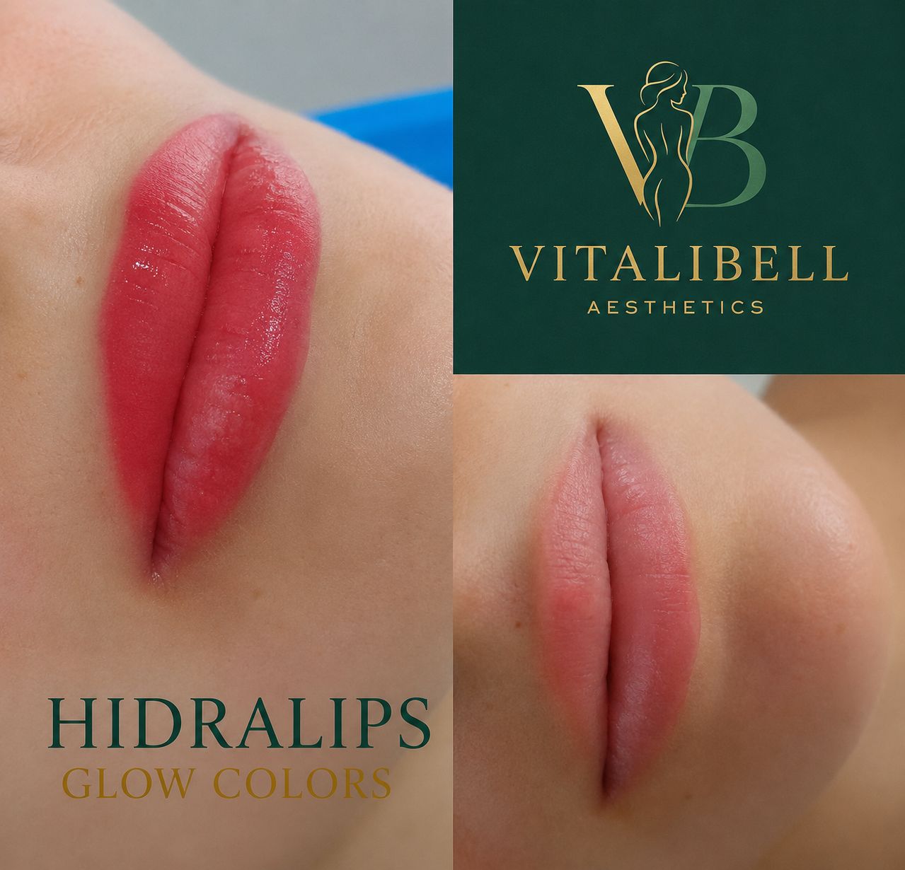 HydraLift Glow — infusión de labios con ácido hialurónico